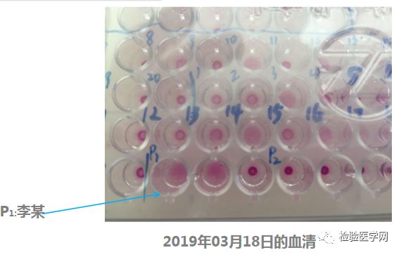 一个月TPPA，探索梅毒特异性抗体的变化与意义