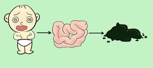 一个月宝宝一天未排便是否正常？解读新生儿排便规律与异常情况