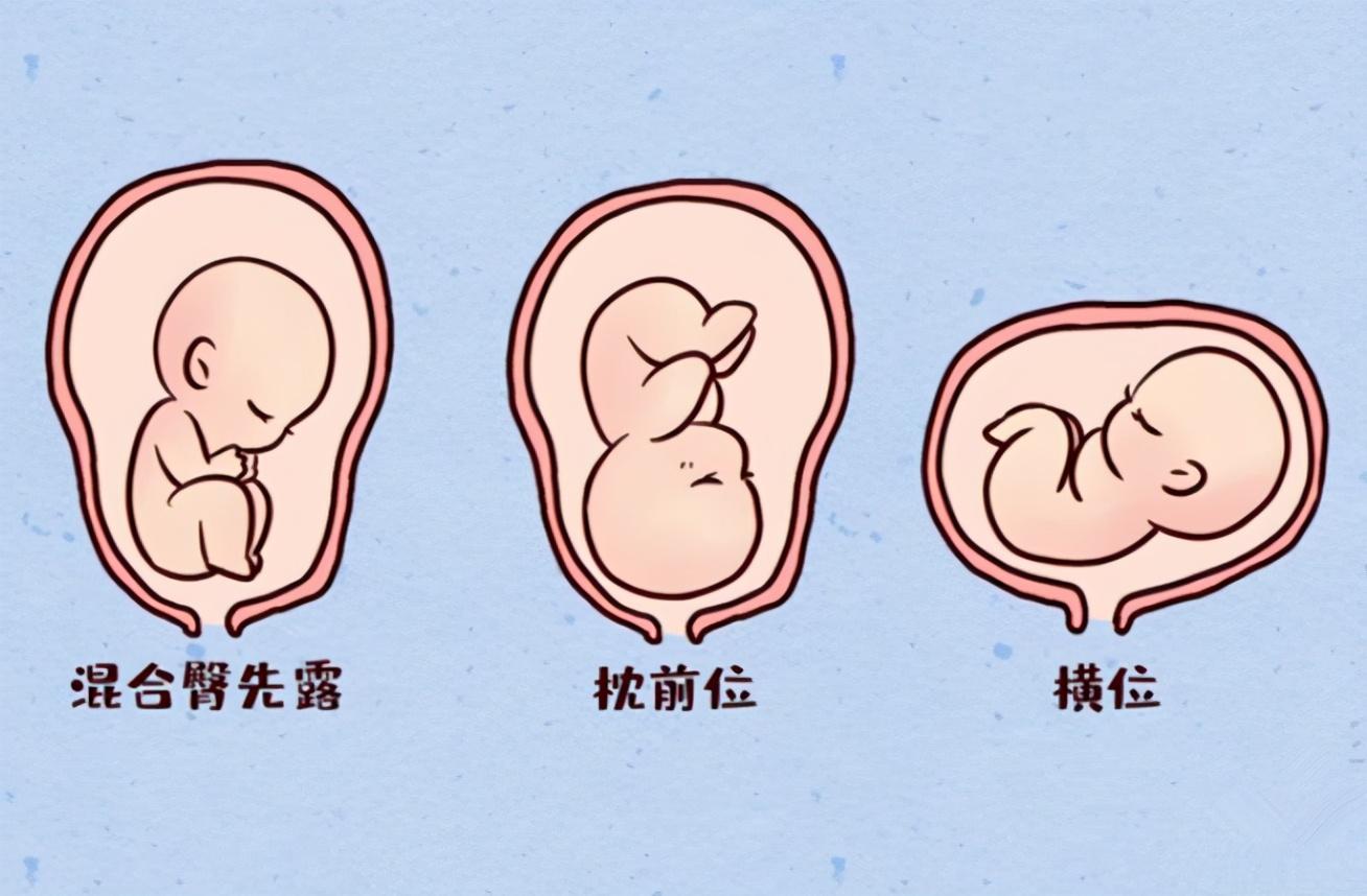 揭秘六个月胎动，如何根据胎动判断胎儿性别？